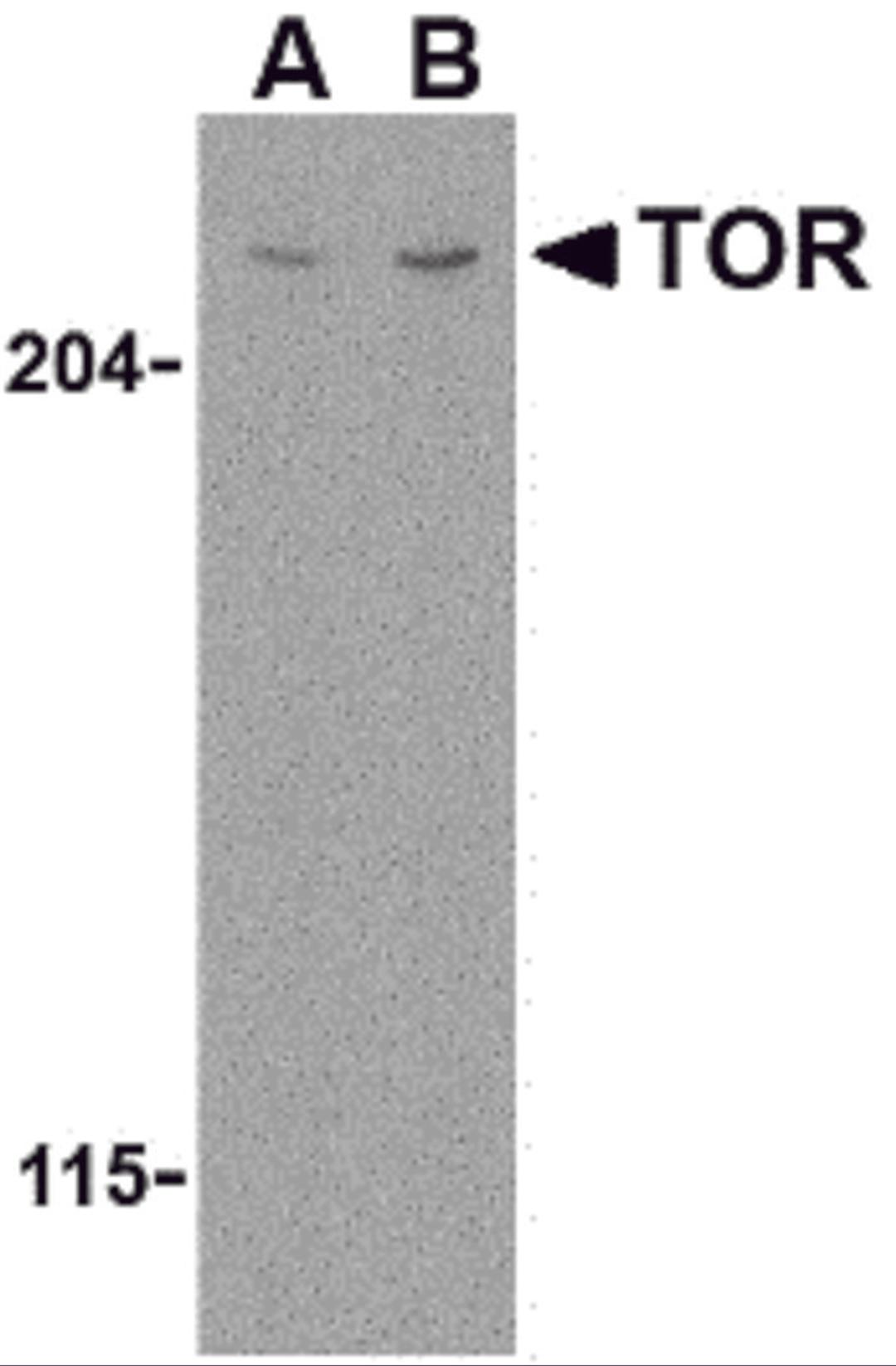 Western blot analysis of TOR in L1210 cell lysate with TOR antibody at (A) 1 and (B) 2 μg/mL.