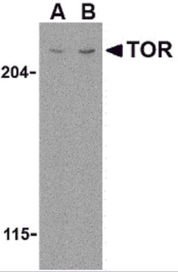Western blot analysis of TOR in L1210 cell lysate with TOR antibody at (A) 1 and (B) 2 μg/mL.