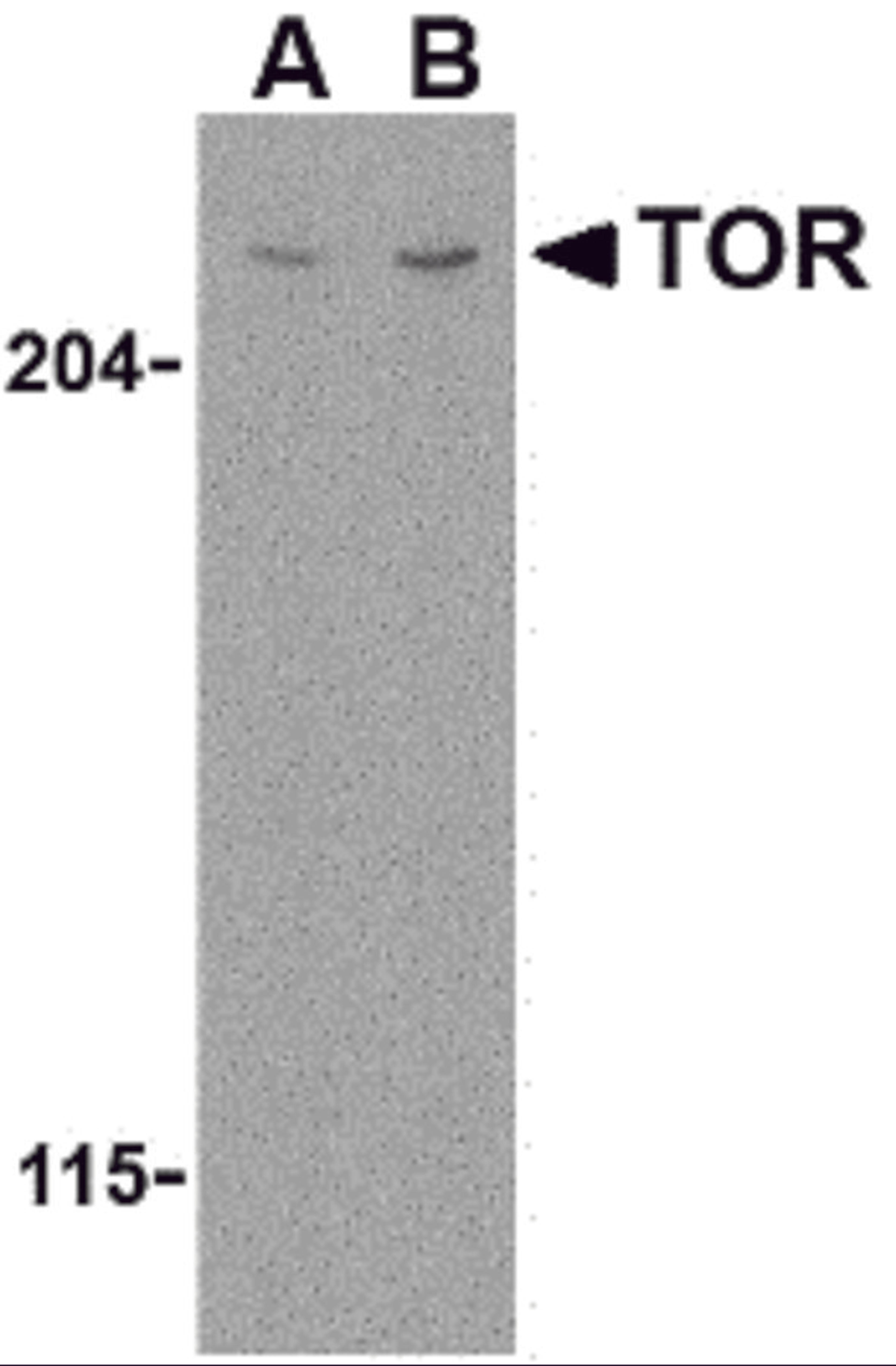 Western blot analysis of TOR in L1210 cell lysate with TOR antibody at (A) 1 and (B) 2 μg/mL.