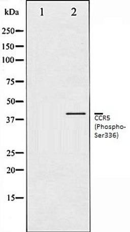 Western blot analysis of Jurkat whole cell lysates using CCR5 (Phospho-Ser336) antibody, The lane on the left is treated with the antigen-specific peptide.