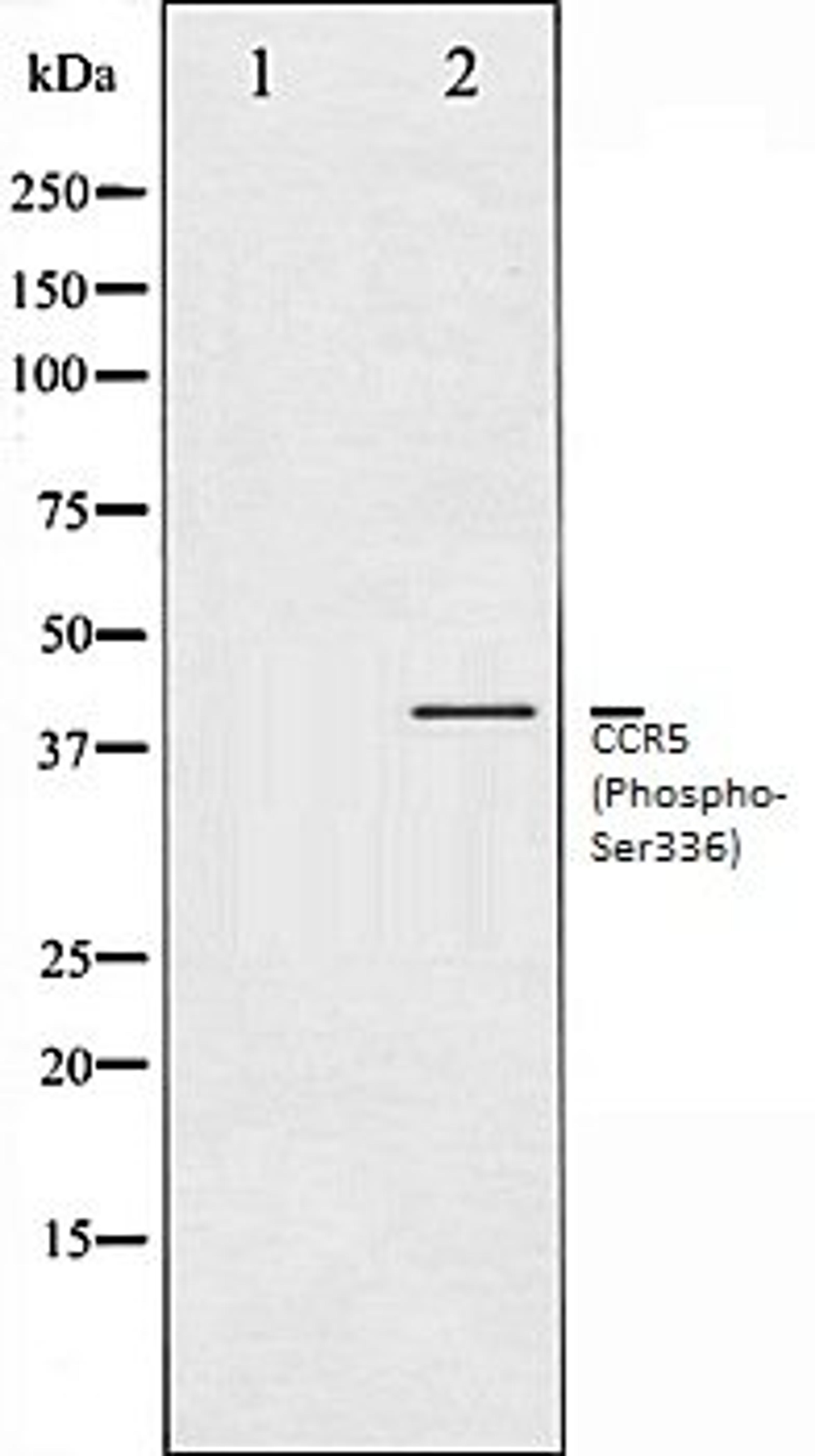 Western blot analysis of Jurkat whole cell lysates using CCR5 (Phospho-Ser336) antibody, The lane on the left is treated with the antigen-specific peptide.