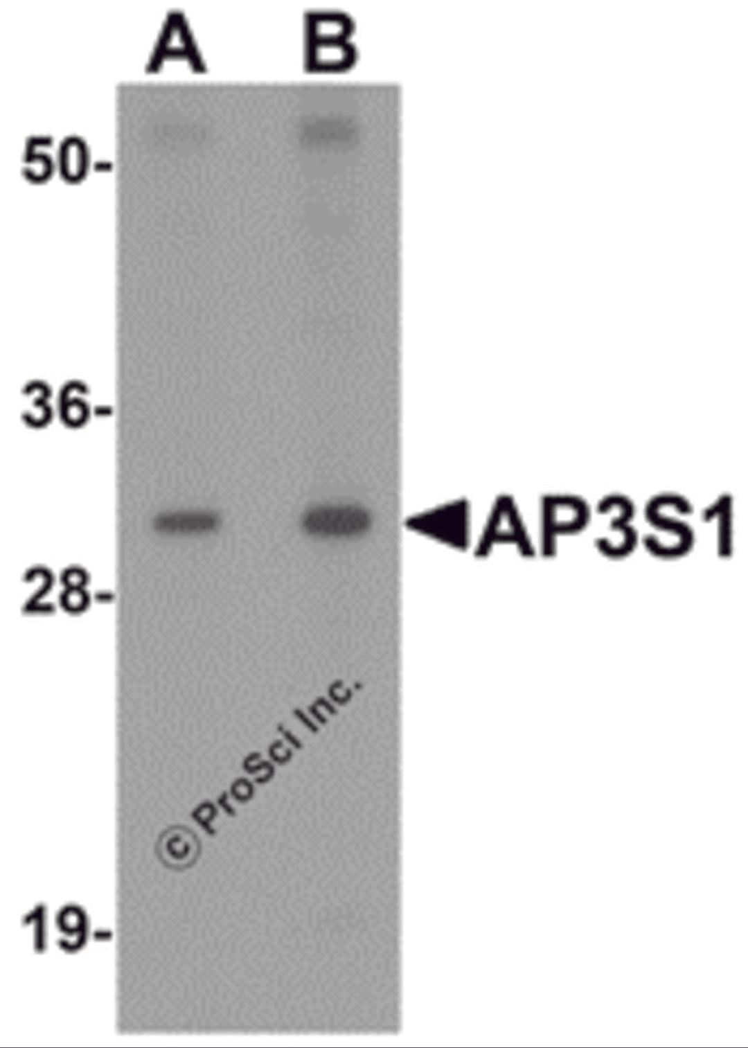 Western blot analysis of AP3S1 in mouse kidney tissue lysate with AP3S1 antibody at (A) 1 and (B) 2 &#956;g/mL .