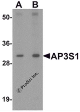 Western blot analysis of AP3S1 in mouse kidney tissue lysate with AP3S1 antibody at (A) 1 and (B) 2 &#956;g/mL .