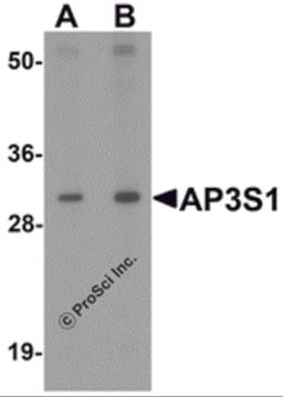Western blot analysis of AP3S1 in mouse kidney tissue lysate with AP3S1 antibody at (A) 1 and (B) 2 μg/mL .