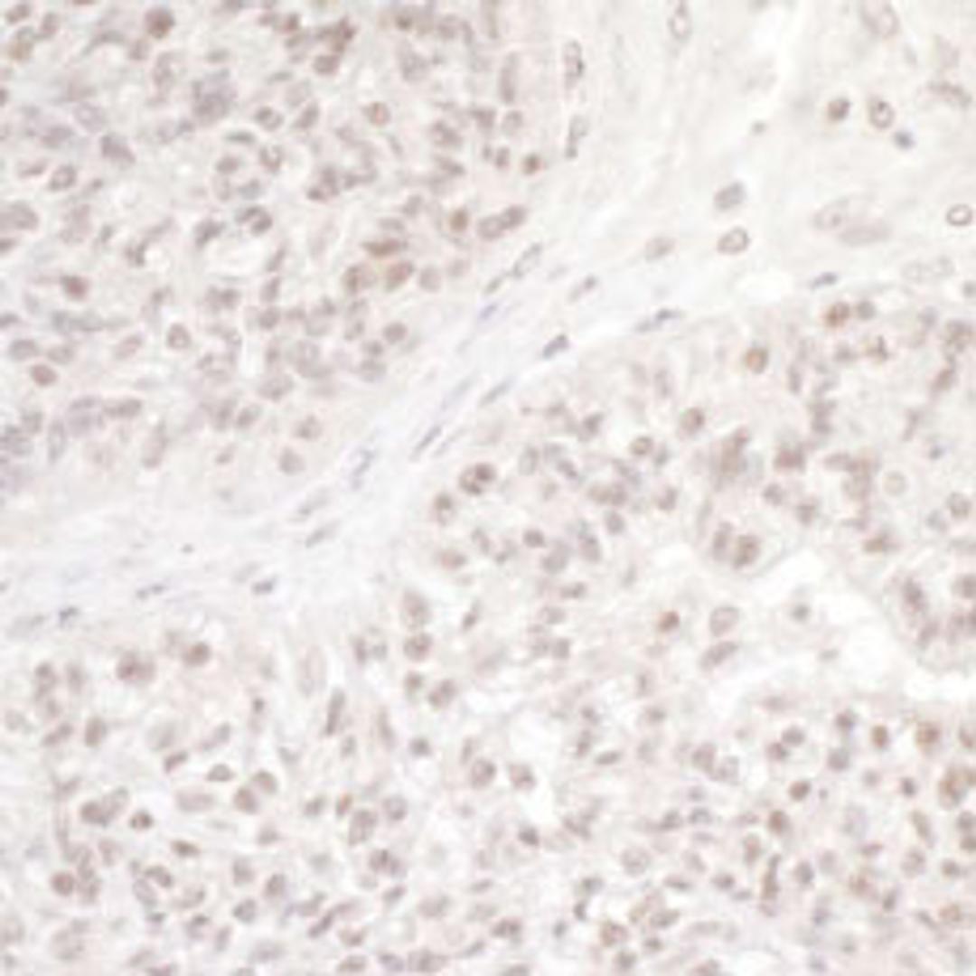 Detection of human DC8 by immunohistochemistry.