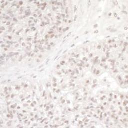 Detection of human DC8 by immunohistochemistry.