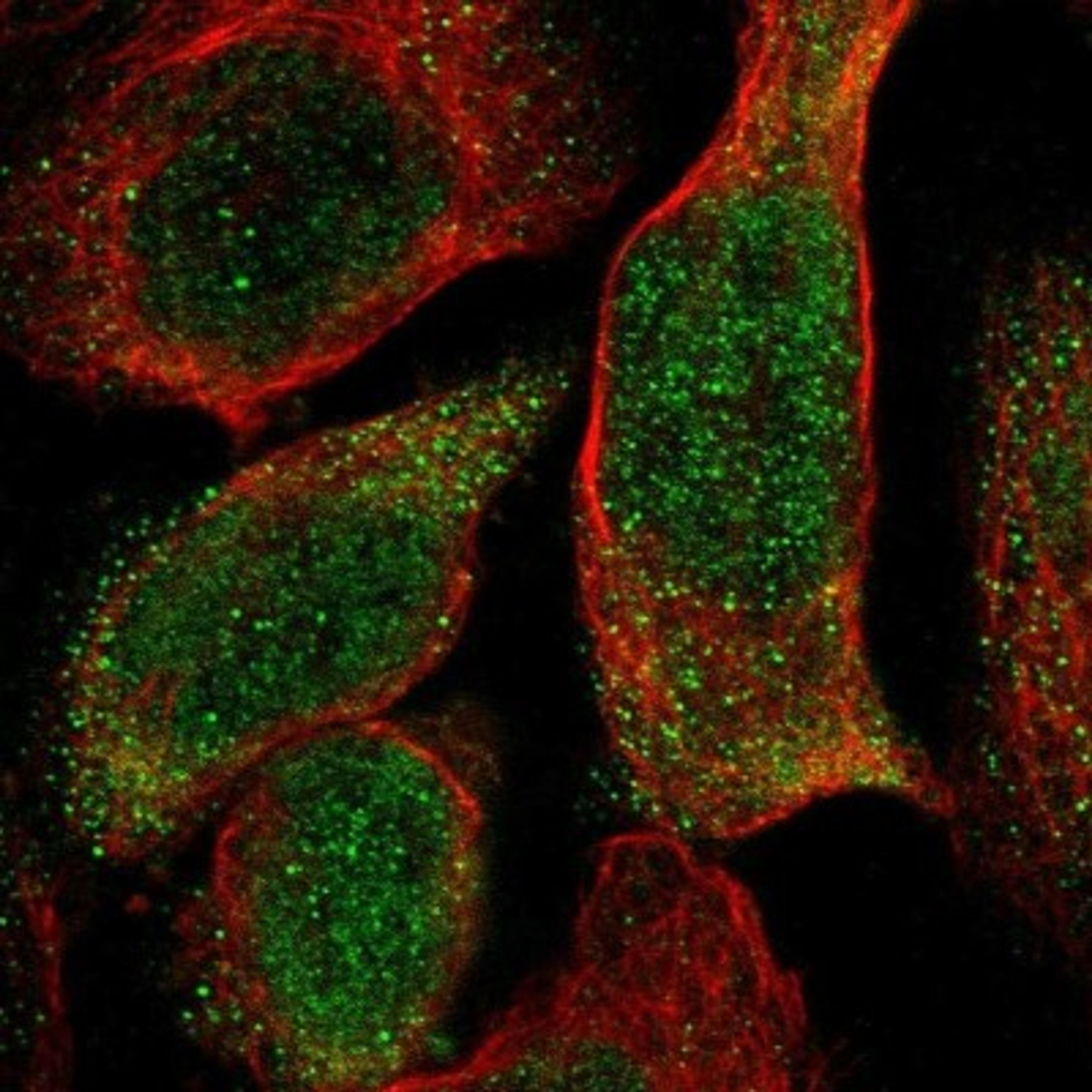 Immunocytochemistry/Immunofluorescence: LRTM1 Antibody [NBP1-81660] - Staining of human cell line A-431 shows positivity in nucleus & cytoplasm.