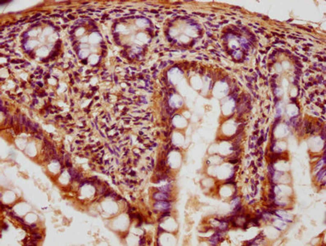 IHC image of CSB-PA019235HA01HU diluted at 1:400 and staining in paraffin-embedded human small intestine tissue performed on a Leica BondTM system. After dewaxing and hydration, antigen retrieval was mediated by high pressure in a citrate buffer (pH 6.0). Section was blocked with 10% normal goat serum 30min at RT. Then primary antibody (1% BSA) was incubated at 4°C overnight. The primary is detected by a biotinylated secondary antibody and visualized using an HRP conjugated SP system.
