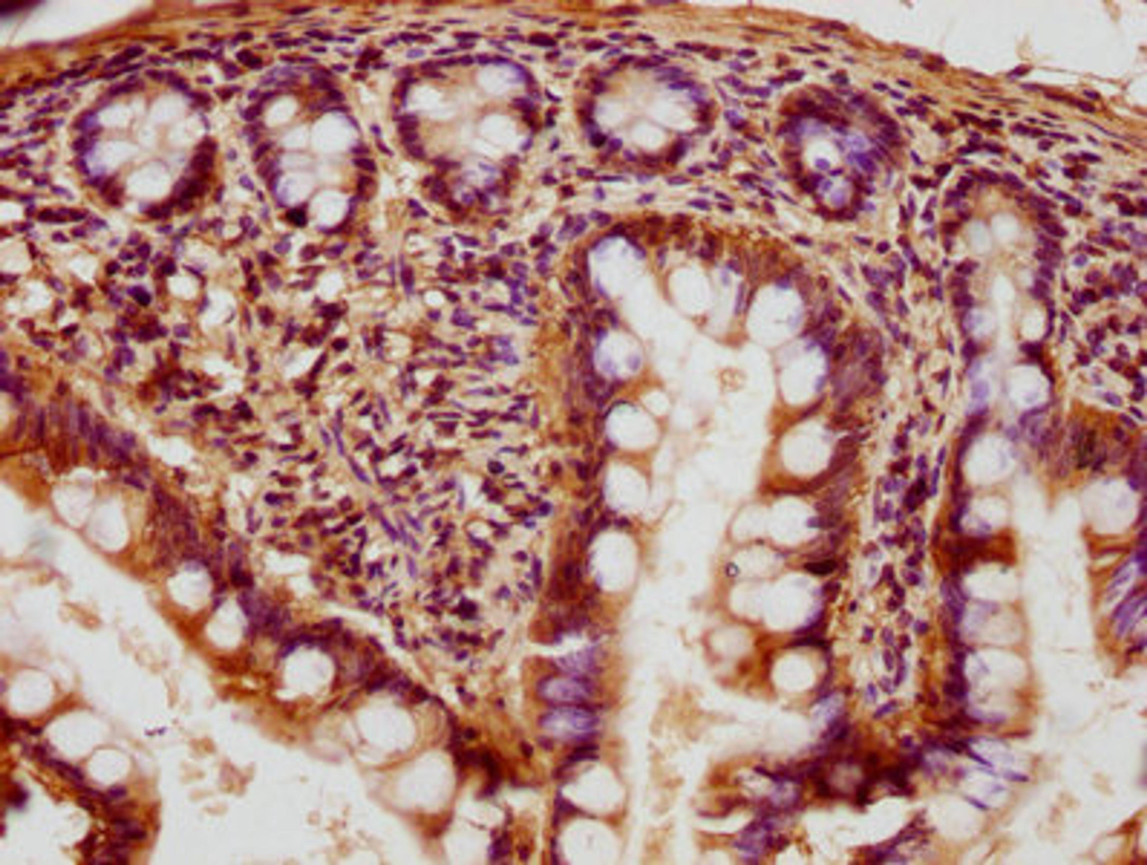 IHC image of CSB-PA019235HA01HU diluted at 1:400 and staining in paraffin-embedded human small intestine tissue performed on a Leica BondTM system. After dewaxing and hydration, antigen retrieval was mediated by high pressure in a citrate buffer (pH 6.0). Section was blocked with 10% normal goat serum 30min at RT. Then primary antibody (1% BSA) was incubated at 4°C overnight. The primary is detected by a biotinylated secondary antibody and visualized using an HRP conjugated SP system.