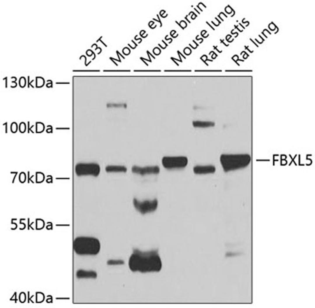 Western blot - FBXL5 antibody (A5602)