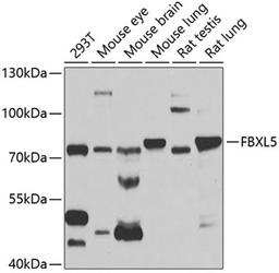 Western blot - FBXL5 antibody (A5602)