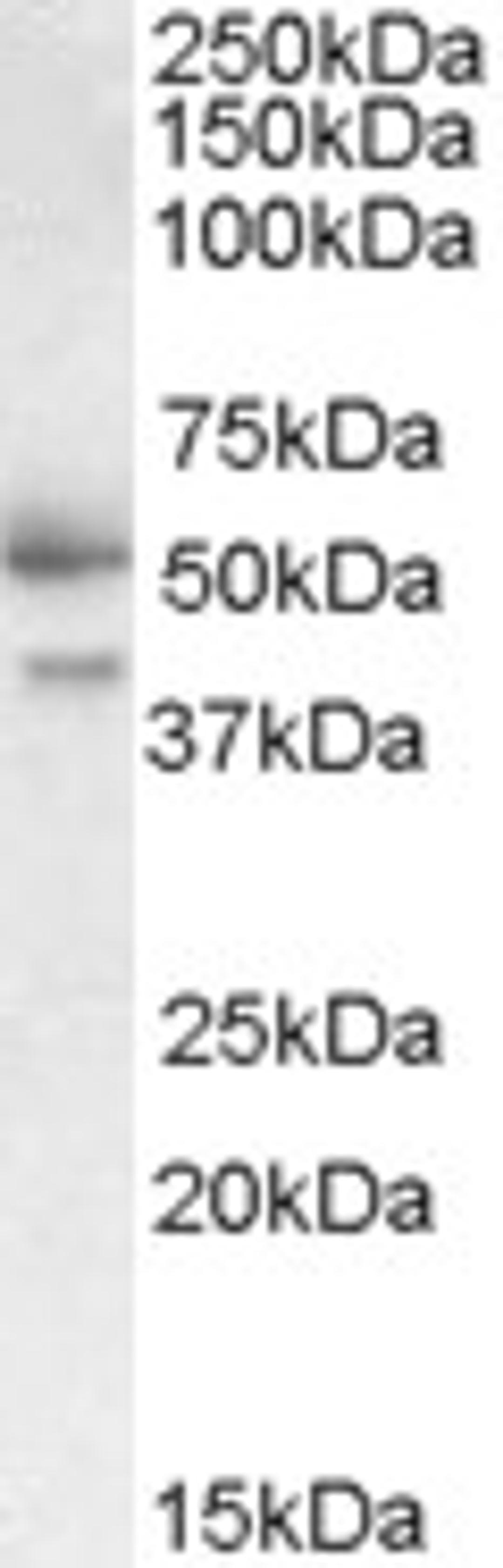 45-640 (0.3ug/ml) staining of Placenta lysate (35ug protein in RIPA buffer). Primary incubation was 1 hour. Detected by chemiluminescence.