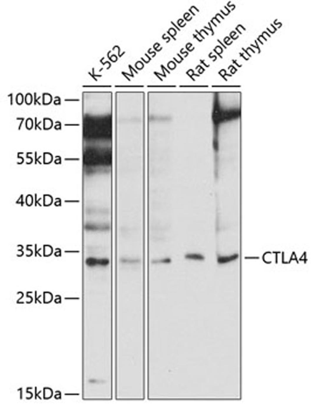 Western blot - CTLA4 antibody (A2063)