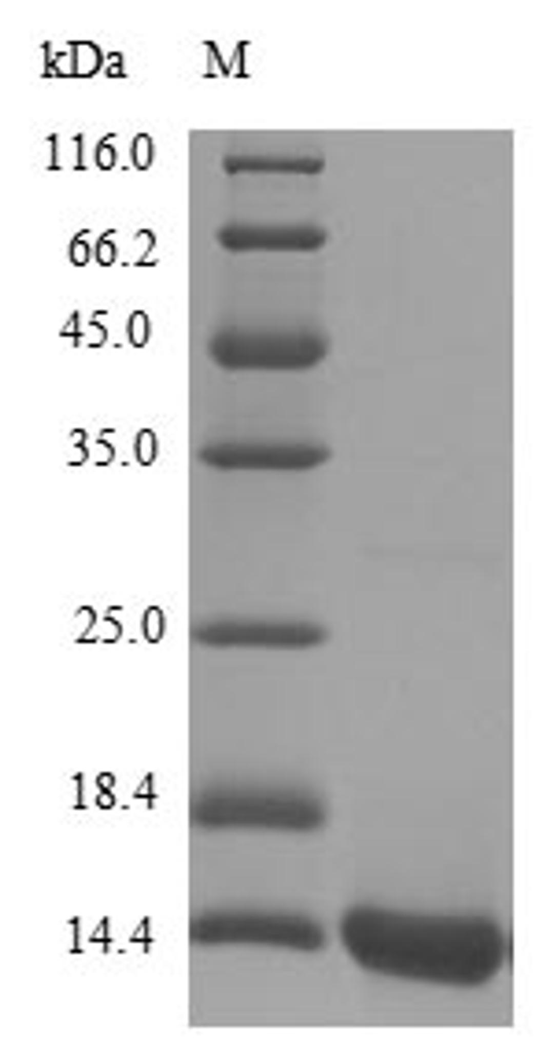 (Tris-Glycine gel) Discontinuous SDS-PAGE (reduced) with 5% enrichment gel and 15% separation gel.