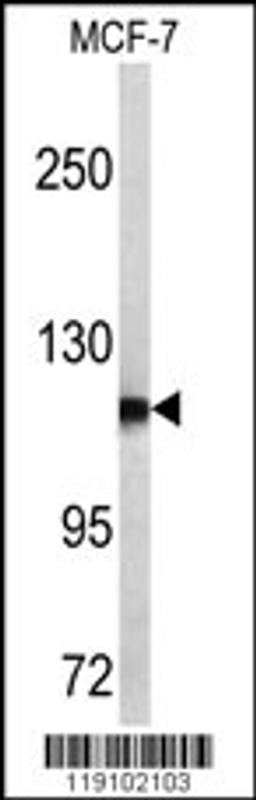 Western blot analysis of PSA antibody in MCF-7 cell line lysates (35ug/lane)