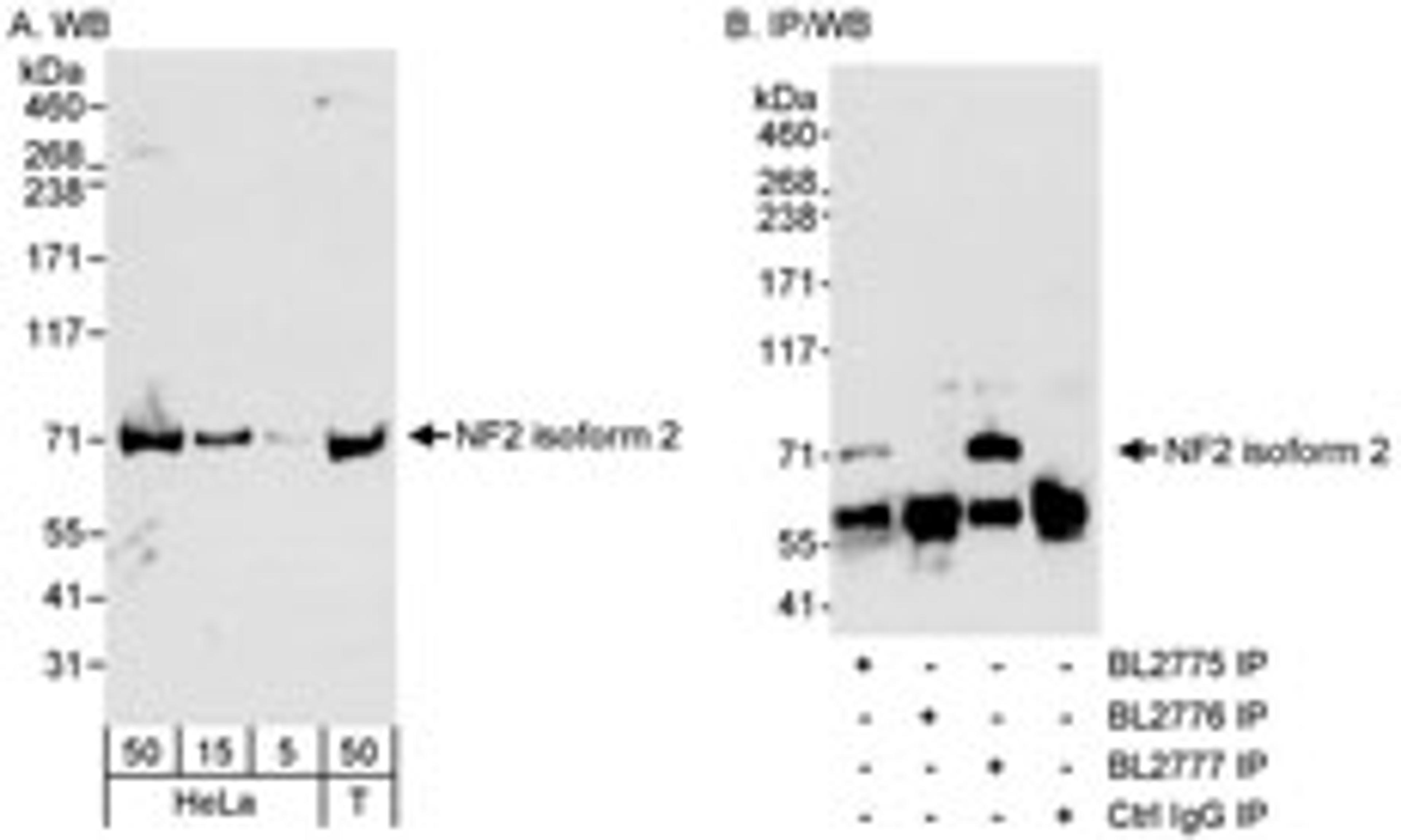 Detection of Isoform 2 of human NF2 by western blot and immunoprecipitation.