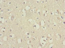 Immunohistochemistry of paraffin-embedded human brain tissue using CSB-PA007535ESR2HU at dilution of 1:100