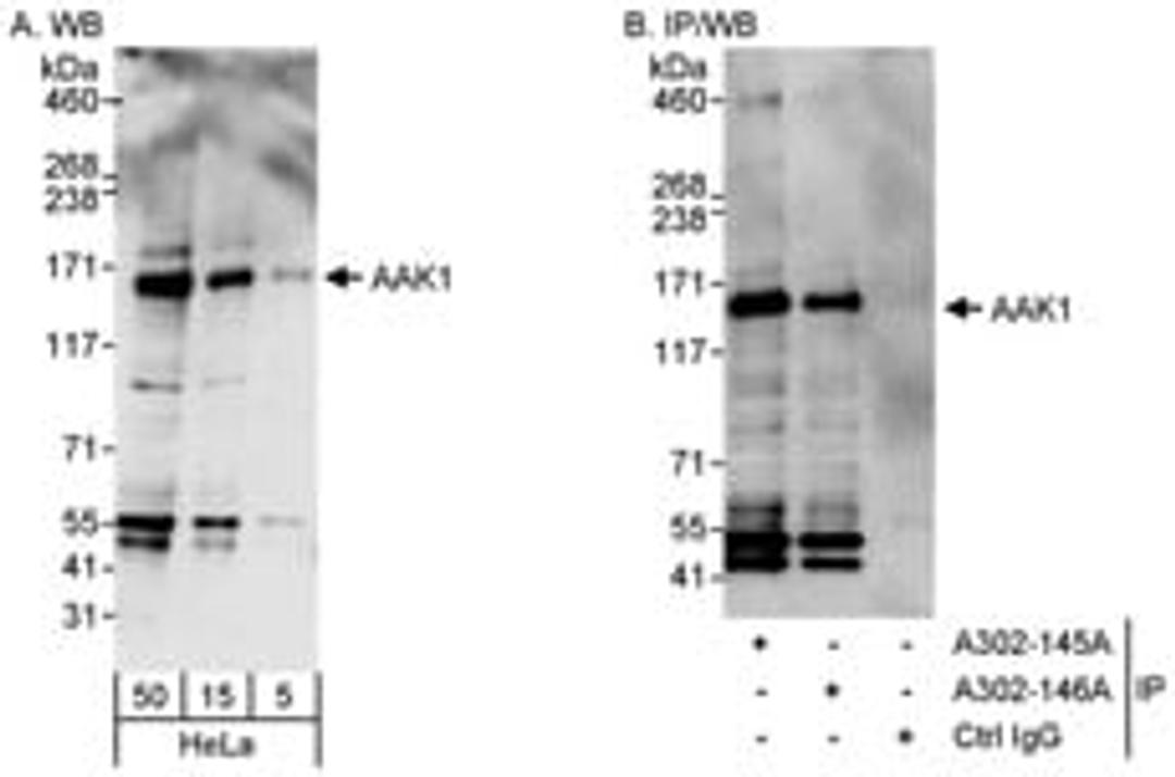 Detection of human AAK1 by western blot and immunoprecipitation.