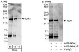 Detection of human AAK1 by western blot and immunoprecipitation.