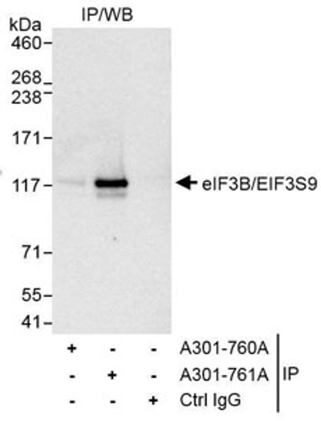 Detection of human and mouse eIF3B/EIF3S9 by western blot of immunoprecipitates.