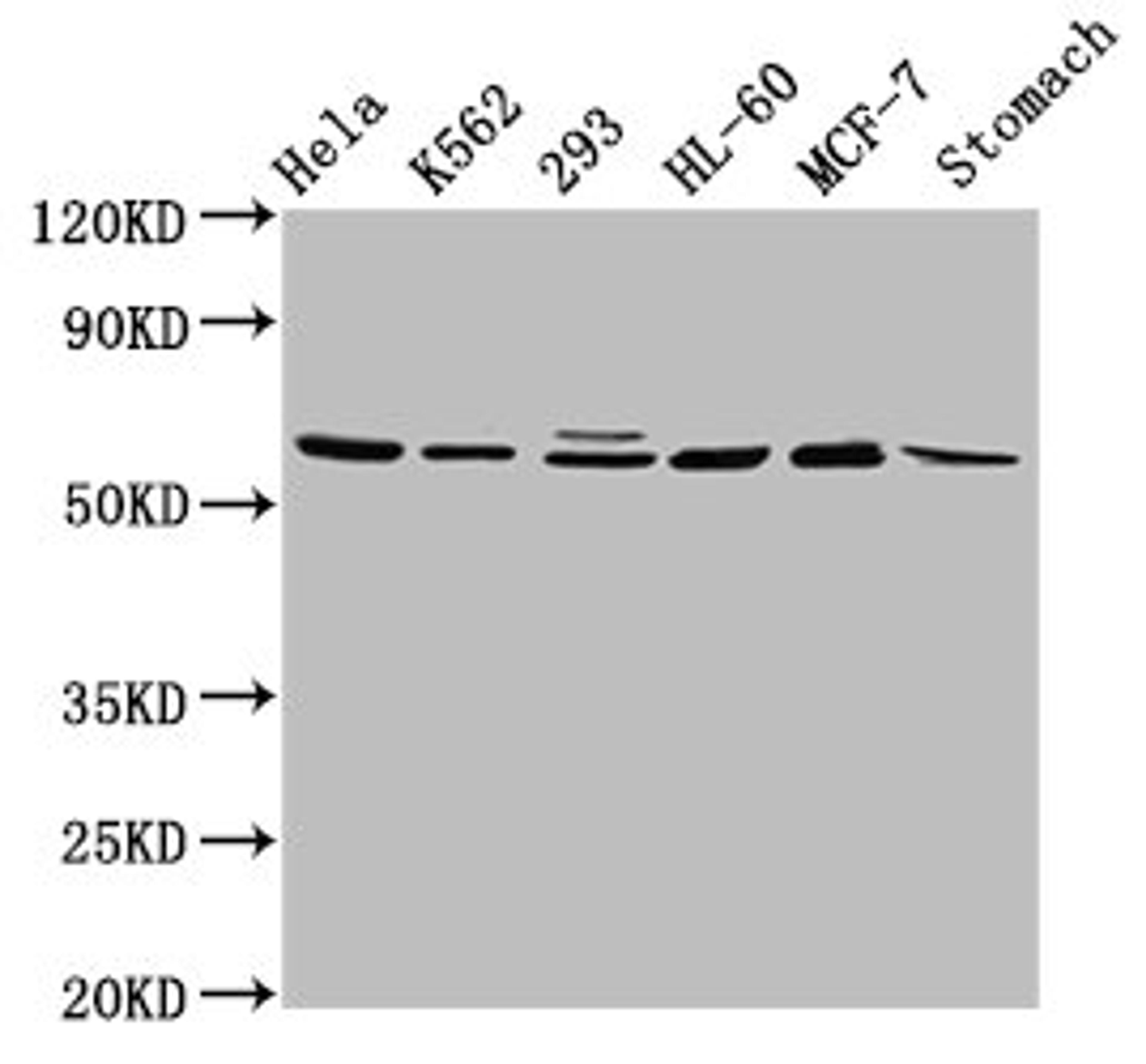 Western Blot. Positive WB detected in: Hela whole cell lysate, K562 whole cell lysate, 293 whole cell lysate, HL60 whole cell lysate, MCF-7 whole cell lysate, Rat stomach tissue. All lanes: GATAD2A antibody at 2.9ug/ml. Secondary. Goat polyclonal to rabbit IgG at 1/50000 dilution. Predicted band size: 69, 66 kDa. Observed band size: 69 kDa. 