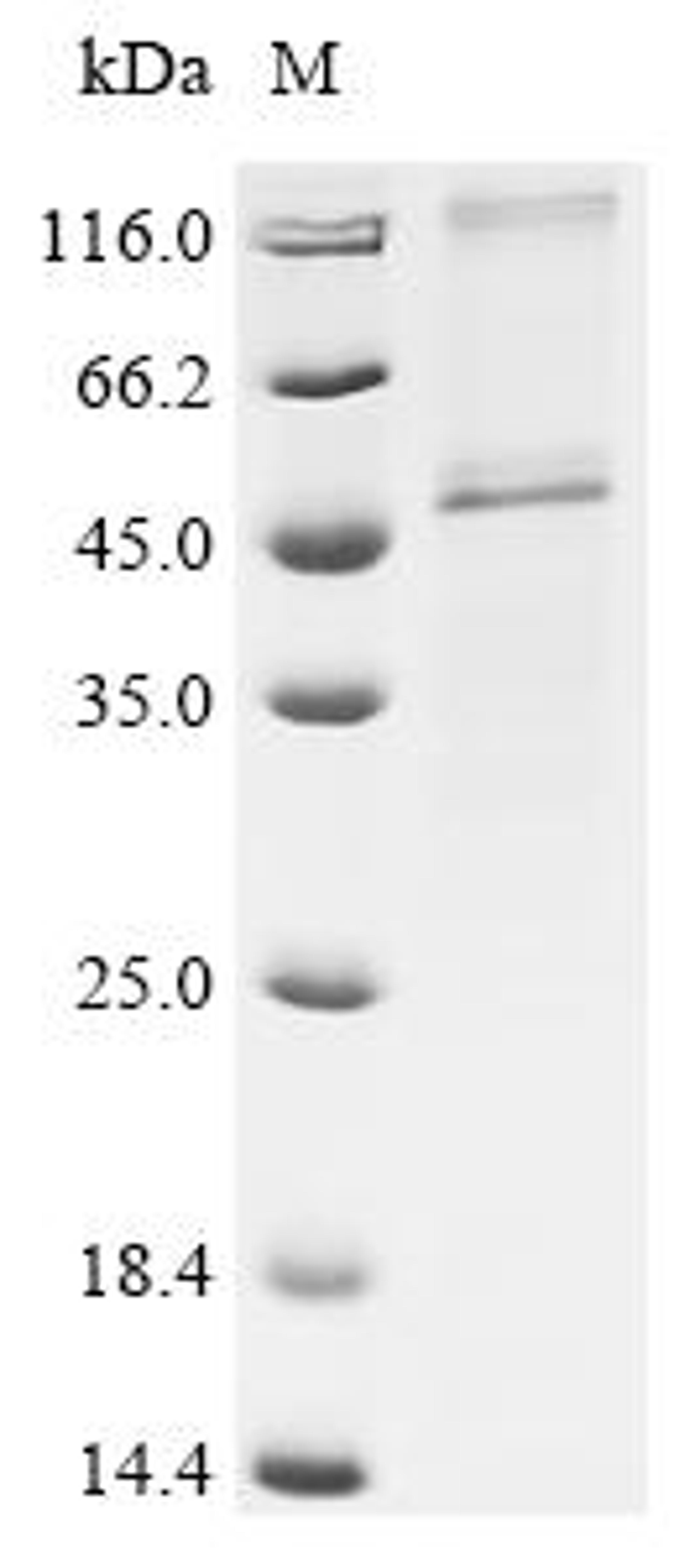 (Tris-Glycine gel) Discontinuous SDS-PAGE (reduced) with 5% enrichment gel and 15% separation gel.