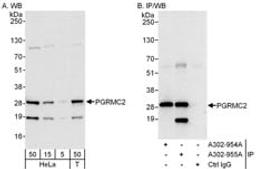 Detection of human PGRMC2 by western blot and immunoprecipitation.