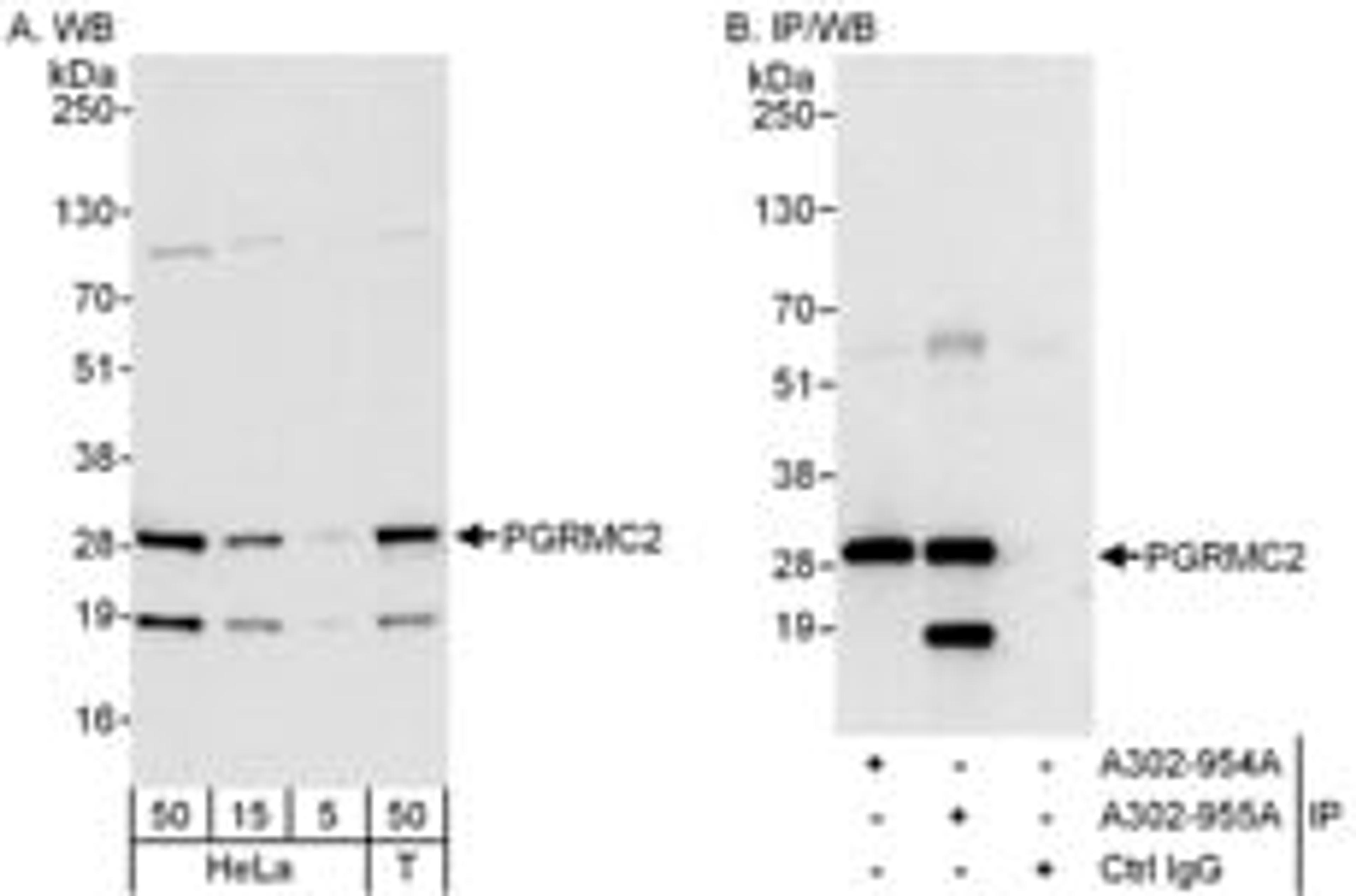 Detection of human PGRMC2 by western blot and immunoprecipitation.