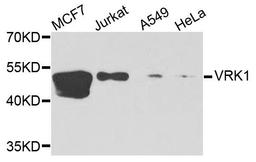 Western blot analysis of extracts of various cells using VRK1 antibody