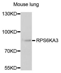 Western blot analysis of extracts of mouse lung using RPS6KA3 antibody