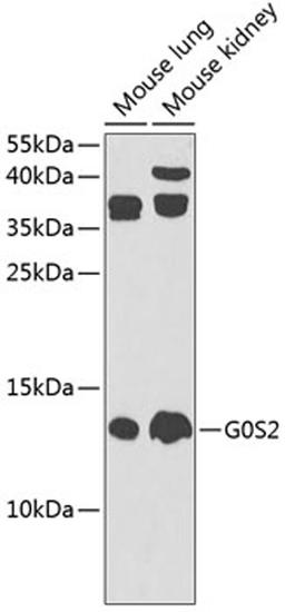 Western blot - G0S2 Antibody (A9970)