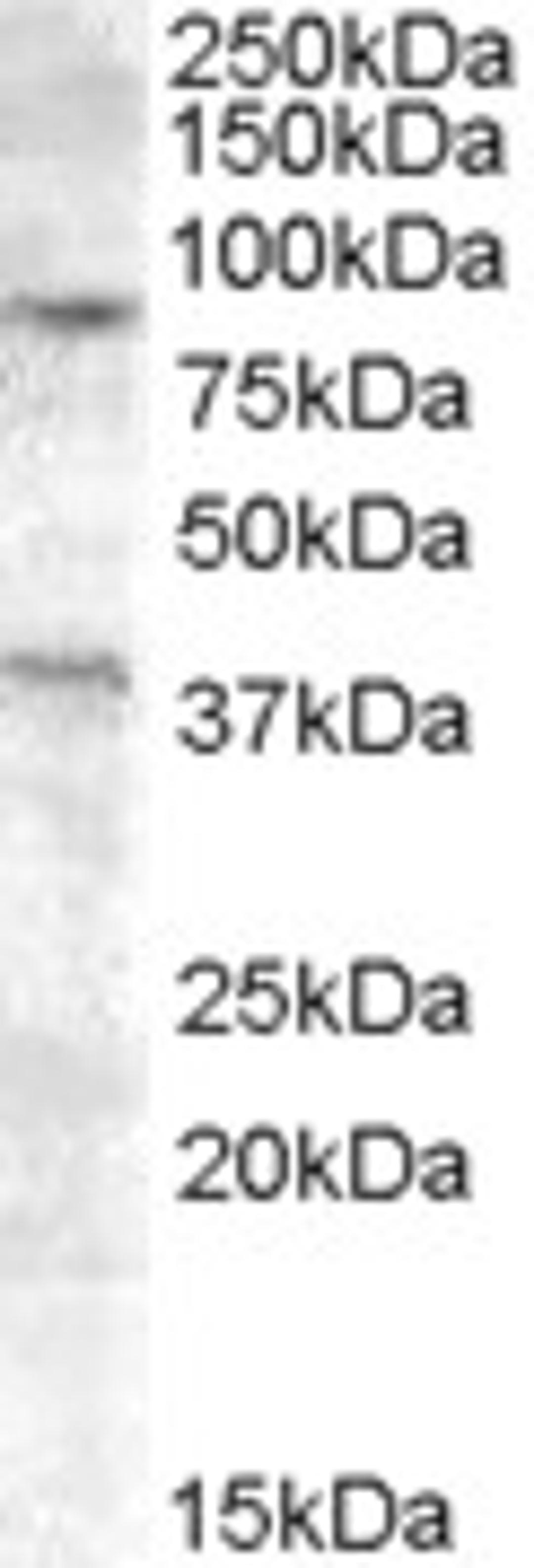 45-556 (0.2ug/ml) staining of A549 cell lysate (35ug protein in RIPA buffer). Primary incubation was 1 hour. Detected by chemiluminescence.