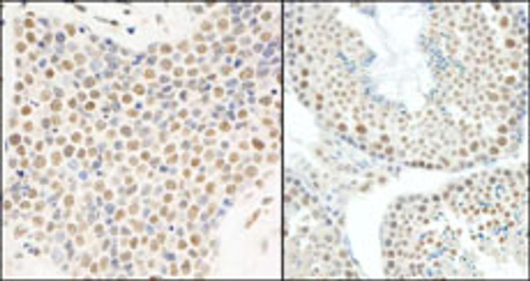 Detection of human and mouse E1B-AP5 by immunohistochemistry.