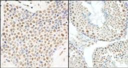 Detection of human and mouse E1B-AP5 by immunohistochemistry.