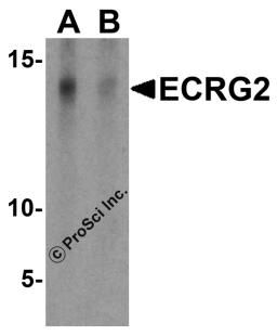 Western blot analysis of ECRG2 in A-20 cell lysate with ECRG2 antibody at 1 &#956;g/mL in the (A) absence and (B) presence of blocking peptide.