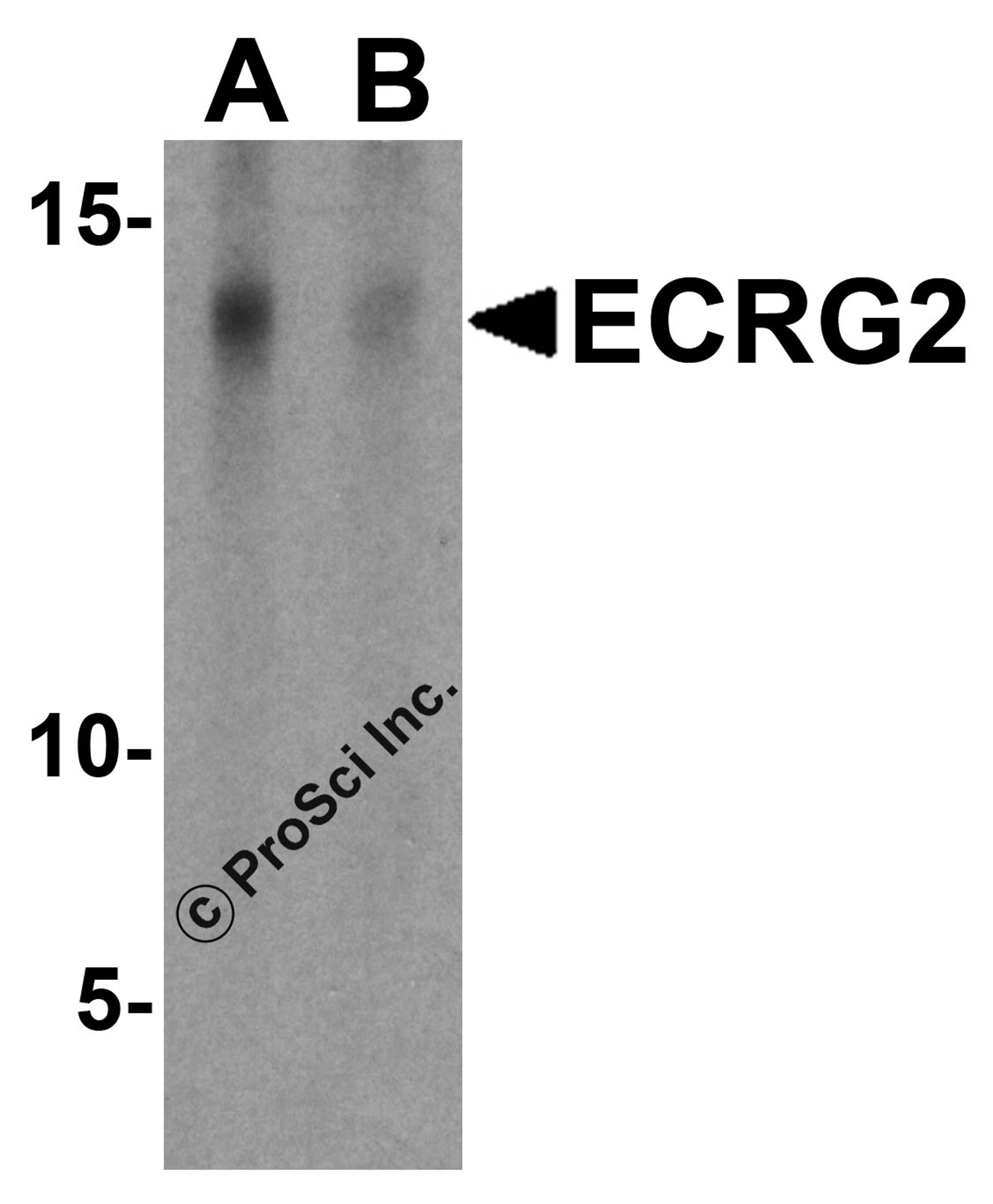 Western blot analysis of ECRG2 in A-20 cell lysate with ECRG2 antibody at 1 μg/mL in the (A) absence and (B) presence of blocking peptide.