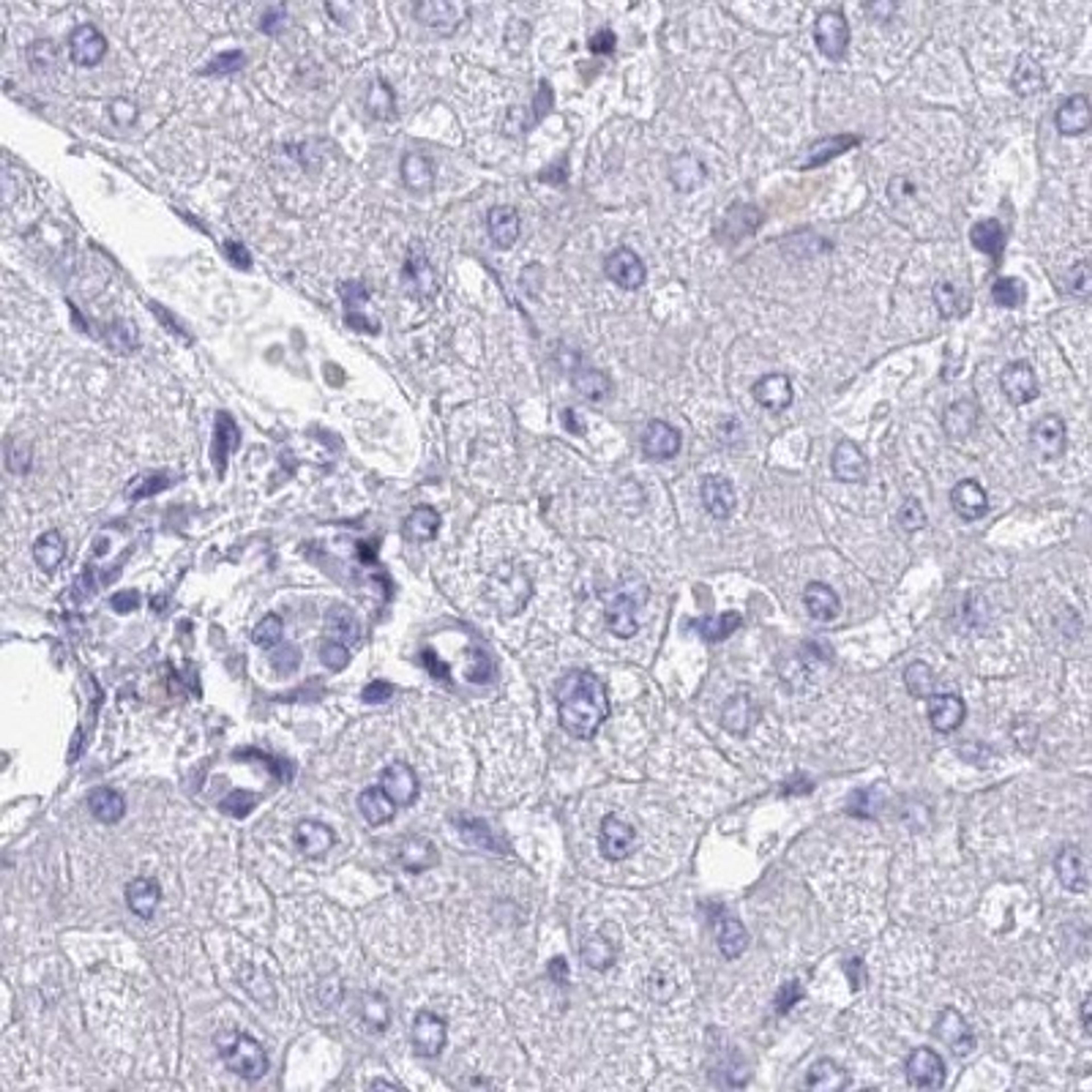 Immunohistochemistry: PLOD1 Antibody [NBP2-31885] - Liver