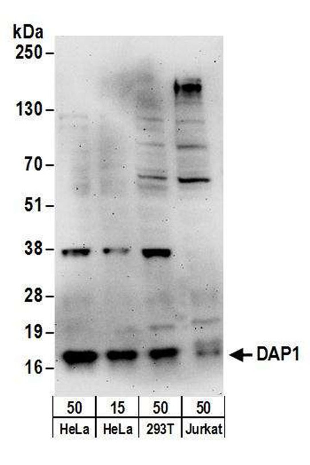 Detection of human DAP1 by WB.