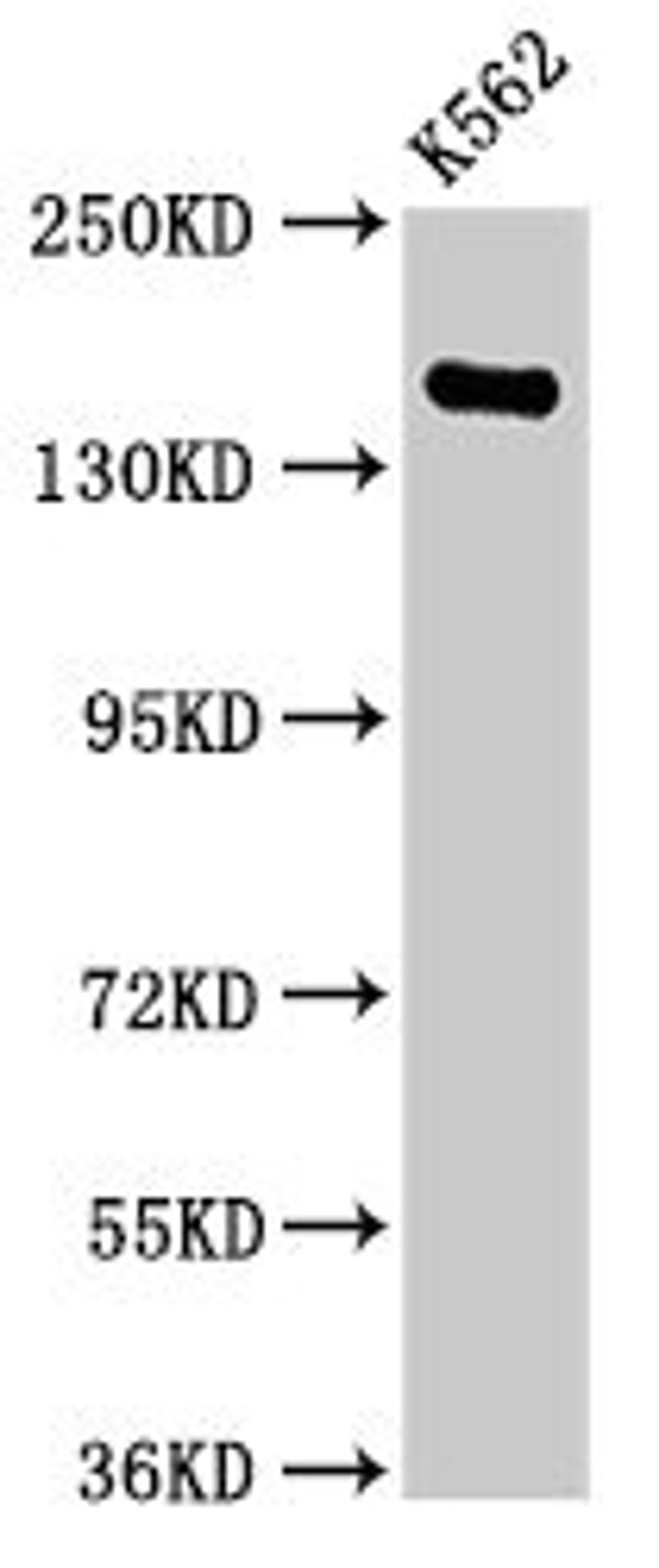 Western Blot. Positive WB detected in: K562 whole cell lysate. All lanes: FGD6 antibody at 2.8µg/ml. Secondary. Goat polyclonal to rabbit IgG at 1/50000 dilution. Predicted band size: 161, 155 kDa. Observed band size: 161 kDa