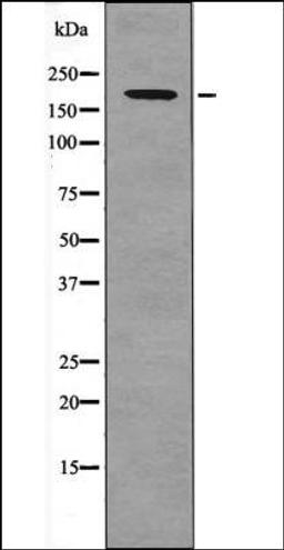 Western blot analysis of EGF treated HuvEc whole cell lysates using PDGFRb -Phospho-Tyr857- antibody