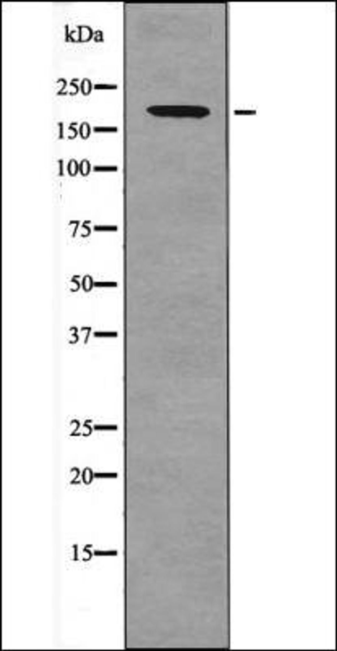 Western blot analysis of EGF treated HuvEc whole cell lysates using PDGFRb -Phospho-Tyr857- antibody
