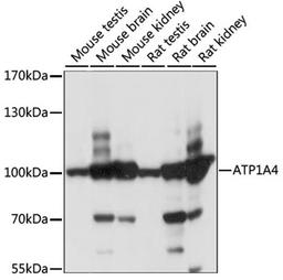 Western blot - ATP1A4 antibody (A15256)