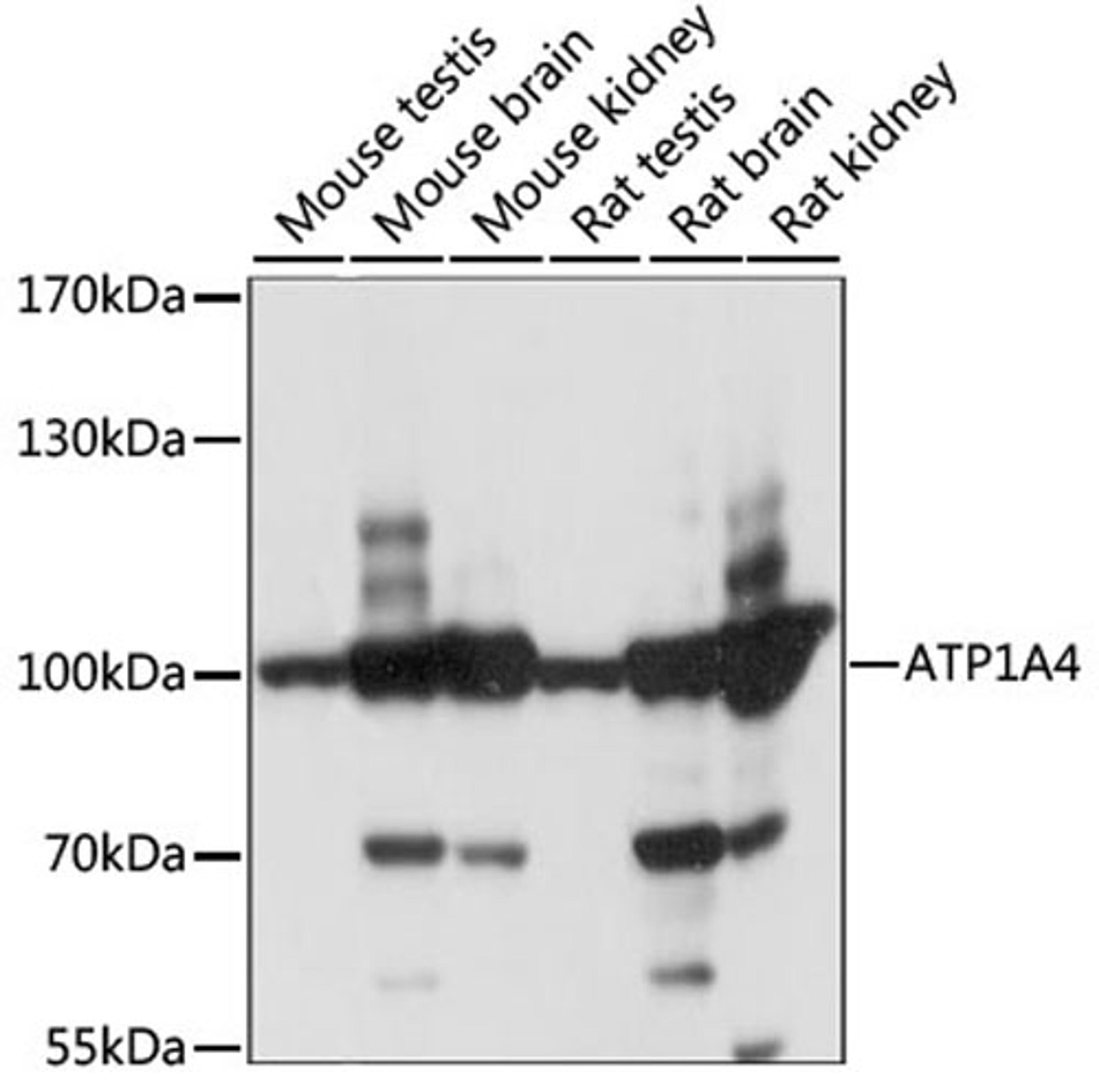 Western blot - ATP1A4 antibody (A15256)