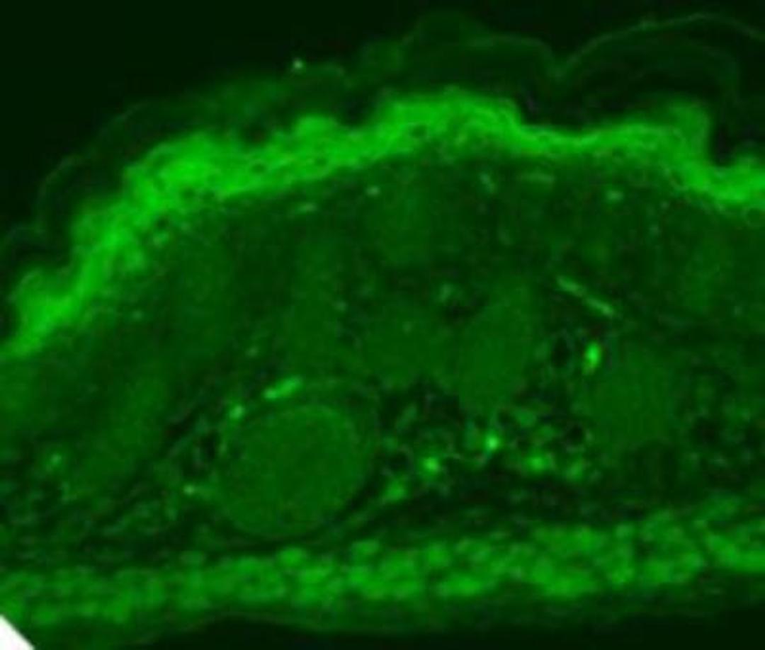 Immunohistochemistry-Paraffin: TRPV3 Antibody (S15-4) [NBP2-12909] - Human hippocampal tissues.