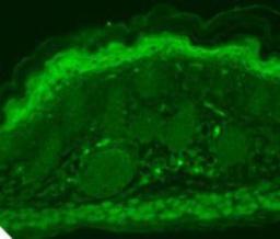 Immunohistochemistry-Paraffin: TRPV3 Antibody (S15-4) [NBP2-12909] - Human hippocampal tissues.