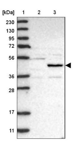 Western Blot: NSUN5 Antibody [NBP1-89416] - Lane 1: Marker [kDa] 230, 130, 95, 72, 56, 36, 28, 17, 11<br/>Lane 2: Human cell line RT-4<br/>Lane 3: Human cell line U-251MG sp