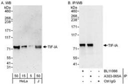 Detection of human TIF-IA by western blot and immunoprecipitation.