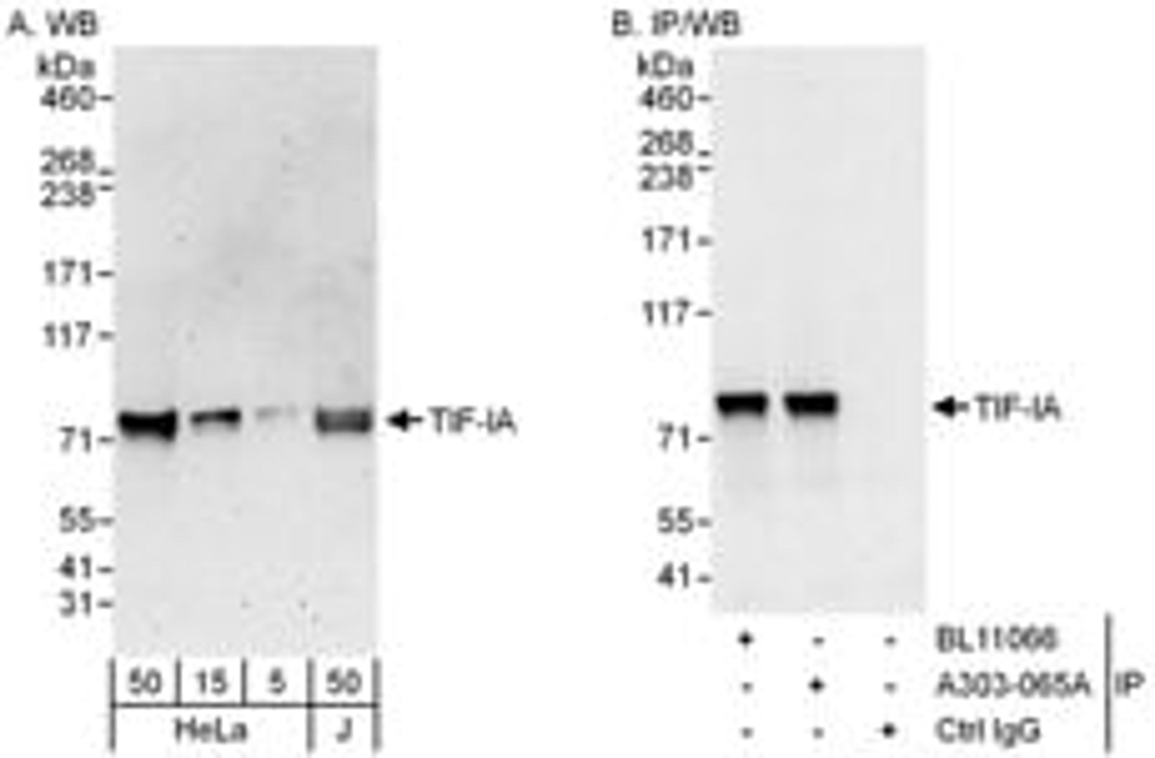 Detection of human TIF-IA by western blot and immunoprecipitation.