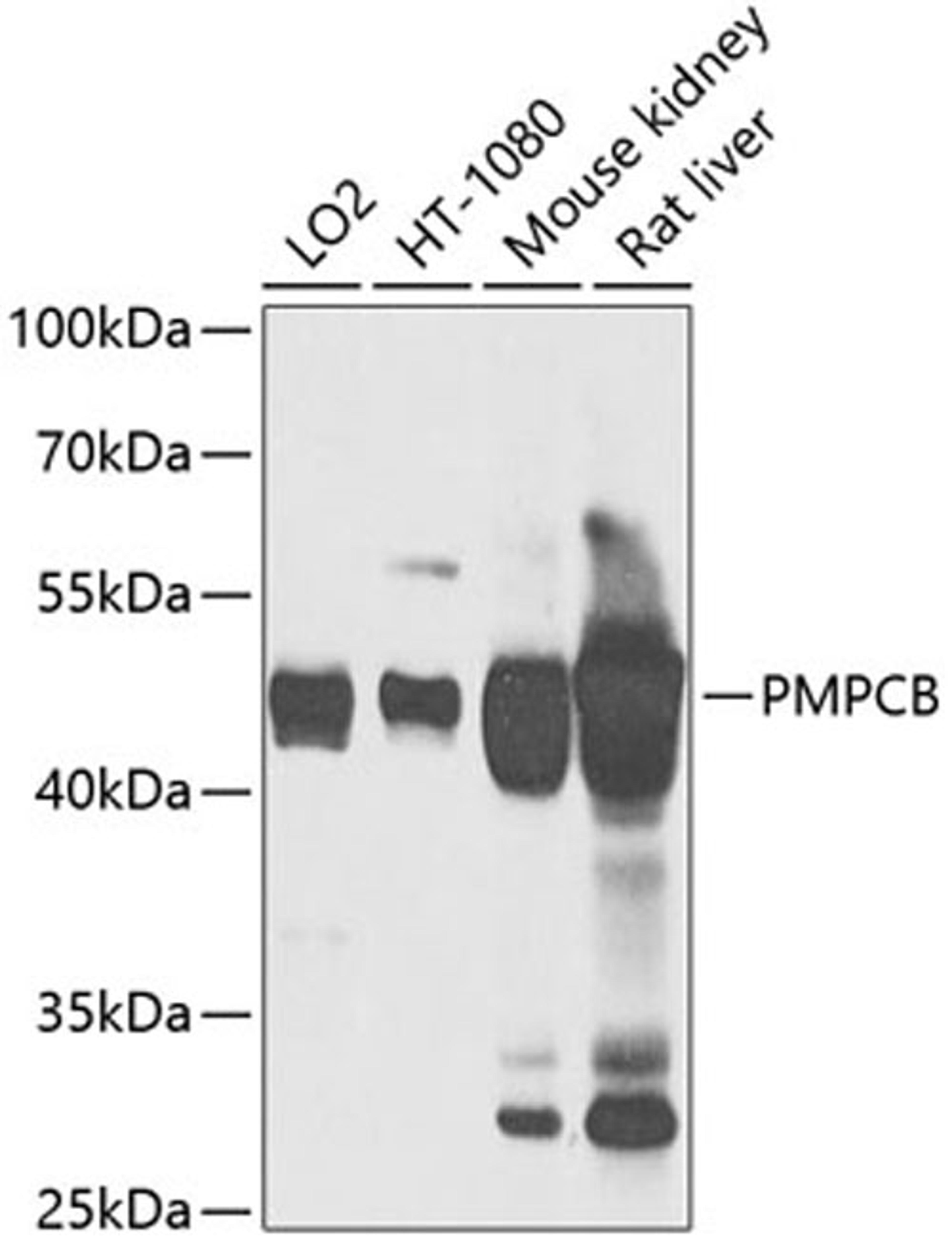 Western blot - PMPCB antibody (A12549)