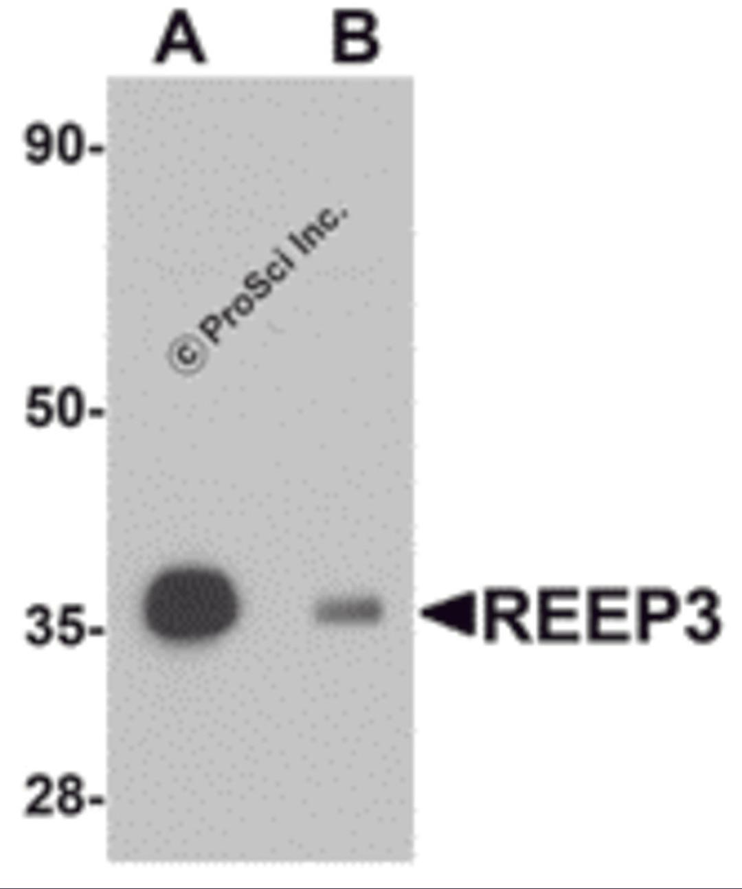 Western blot analysis of REEP3 in rat heart tissue lysate with REEP3 antibody at 1 μg/mL in (A) the absence and (B) the presence of blocking peptide.